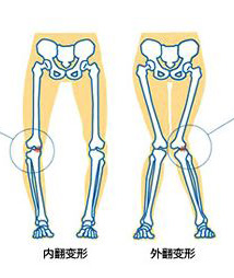 人体微量元素分析仪厂家发生佝偻病的原因是什么呢