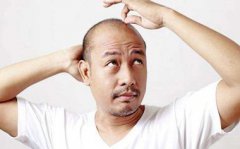 全自动血铅检测仪厂家脱发是微量元素缺乏导致怎么办？