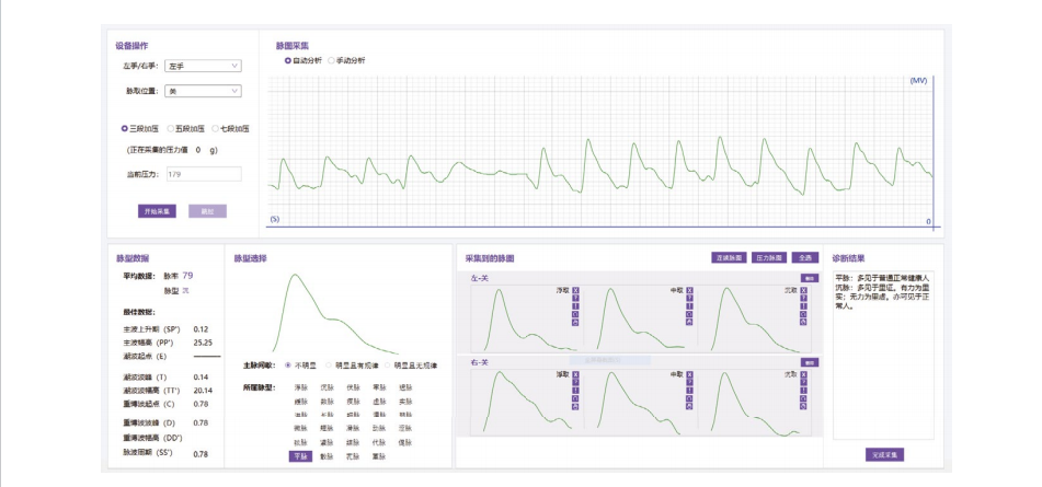 中医脉诊检测仪检测报告